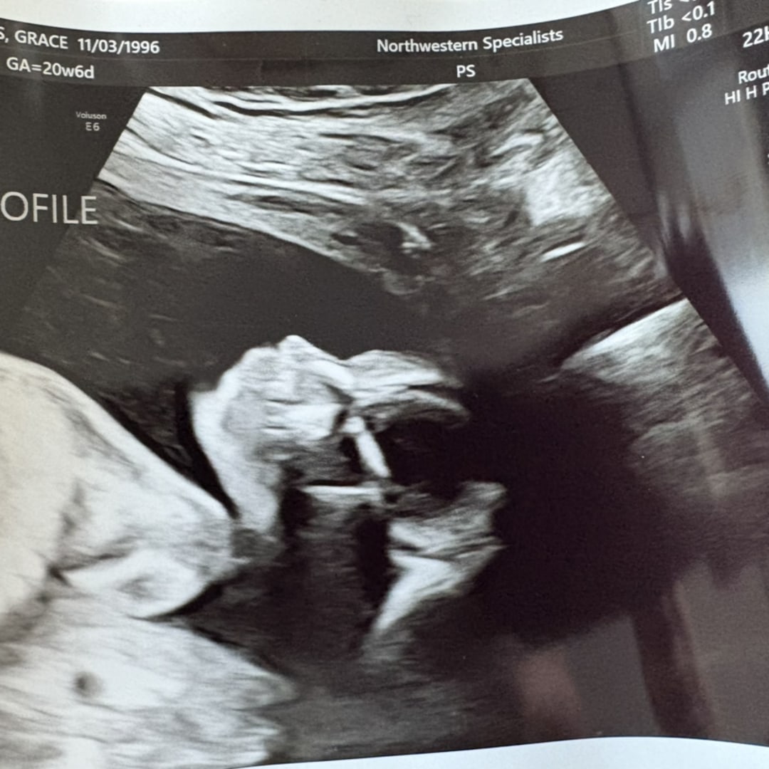 Photo shared by Grace for their Babylist baby registry.