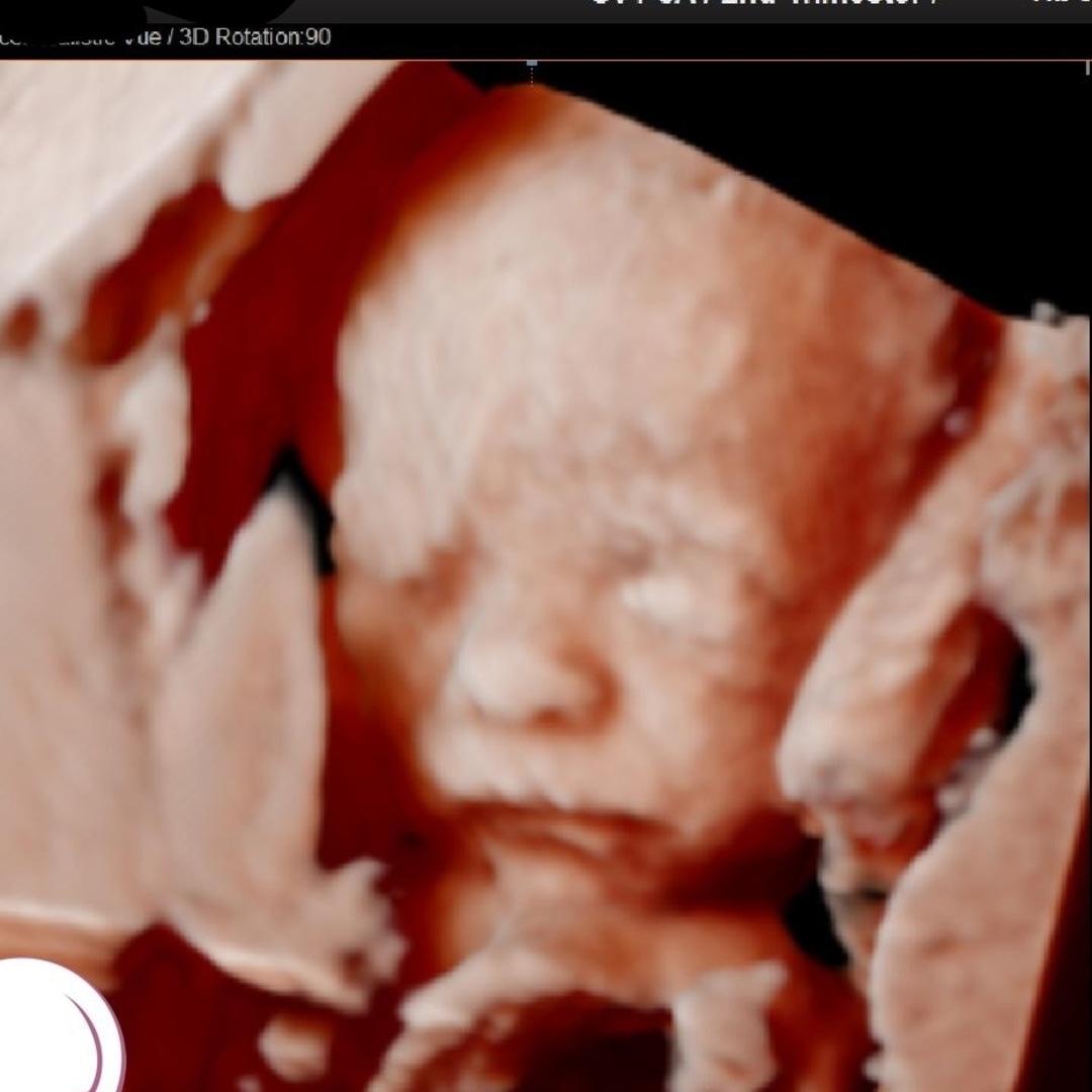 Photo shared by Bethany & Kevin for their Babylist baby registry.