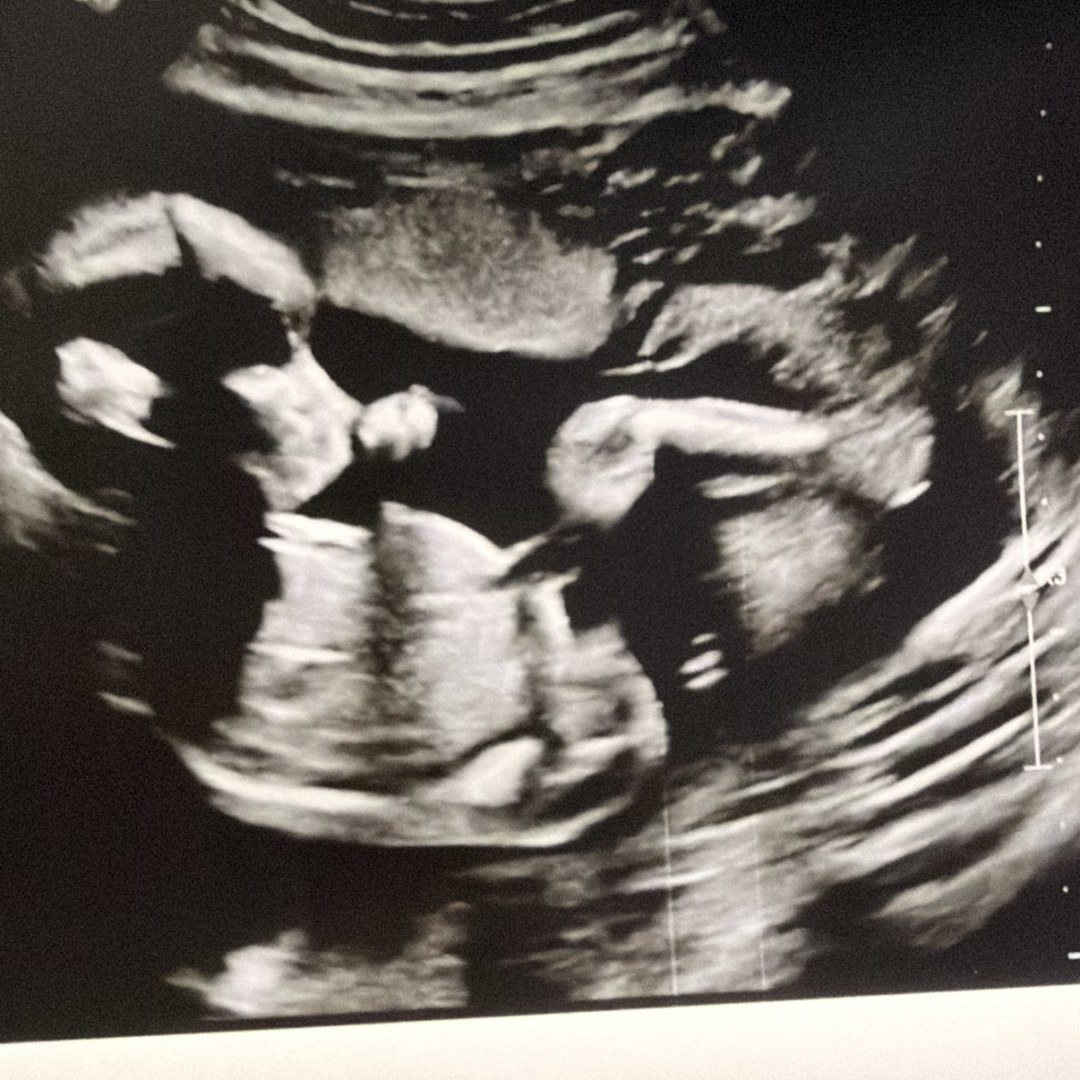 Photo shared by Charlotte for their Babylist baby registry.