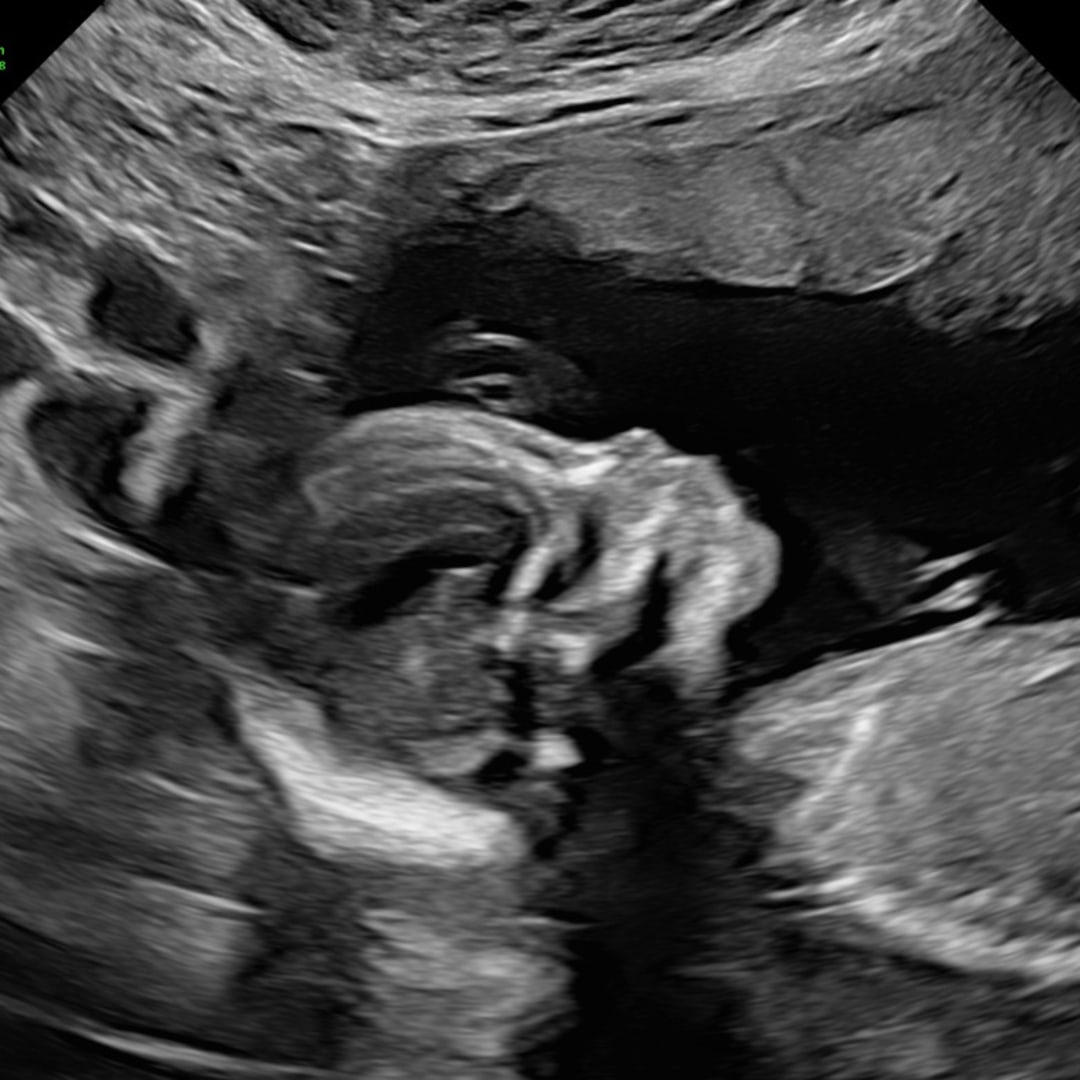 Photo shared by Jessica for their Babylist baby registry.