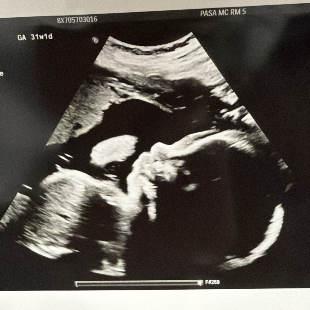 Photo shared by Madeline for their Babylist baby registry.