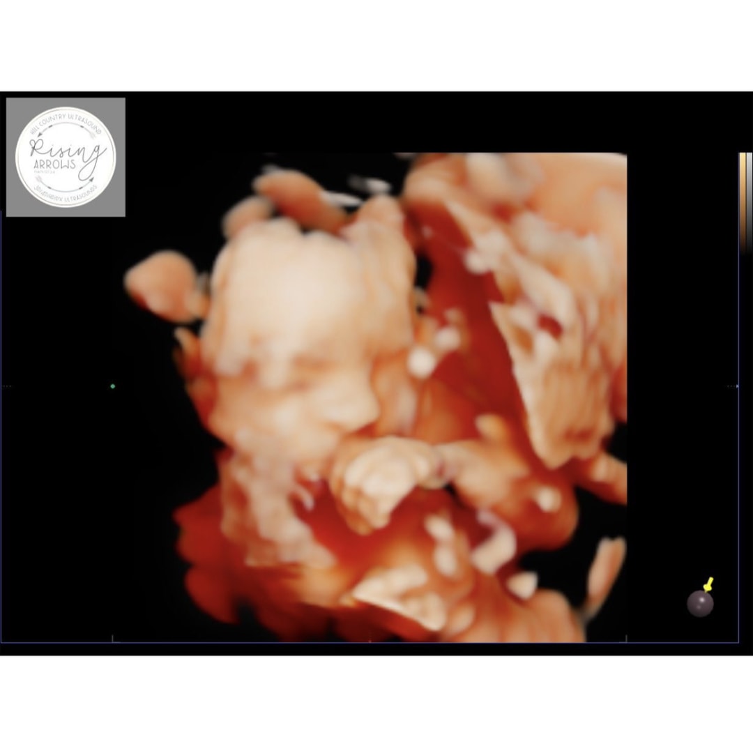 Photo shared by Eliza for their Babylist baby registry.