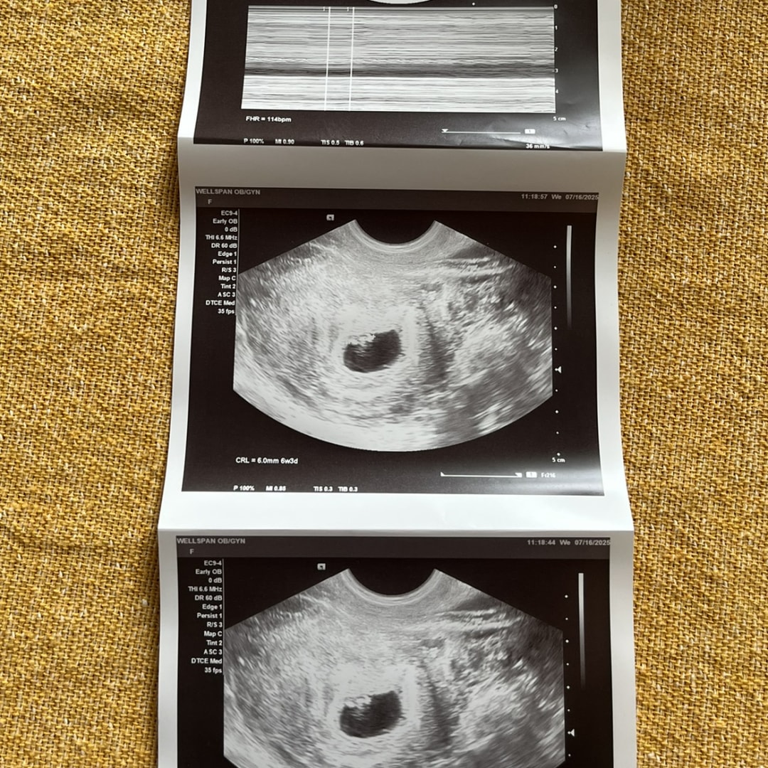 Photo shared by Jeshua for their Babylist baby registry.