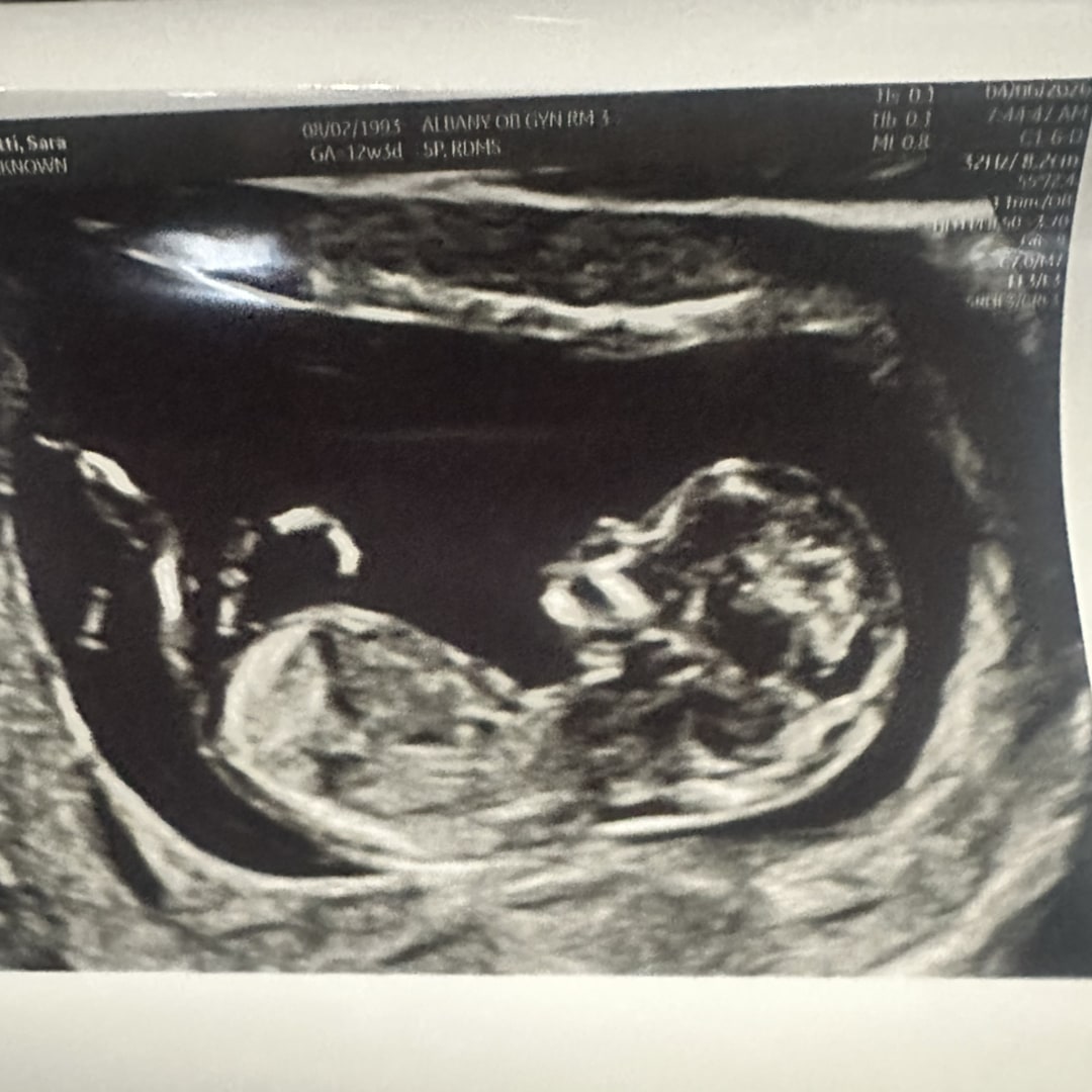 Photo shared by Angel for their Babylist baby registry.