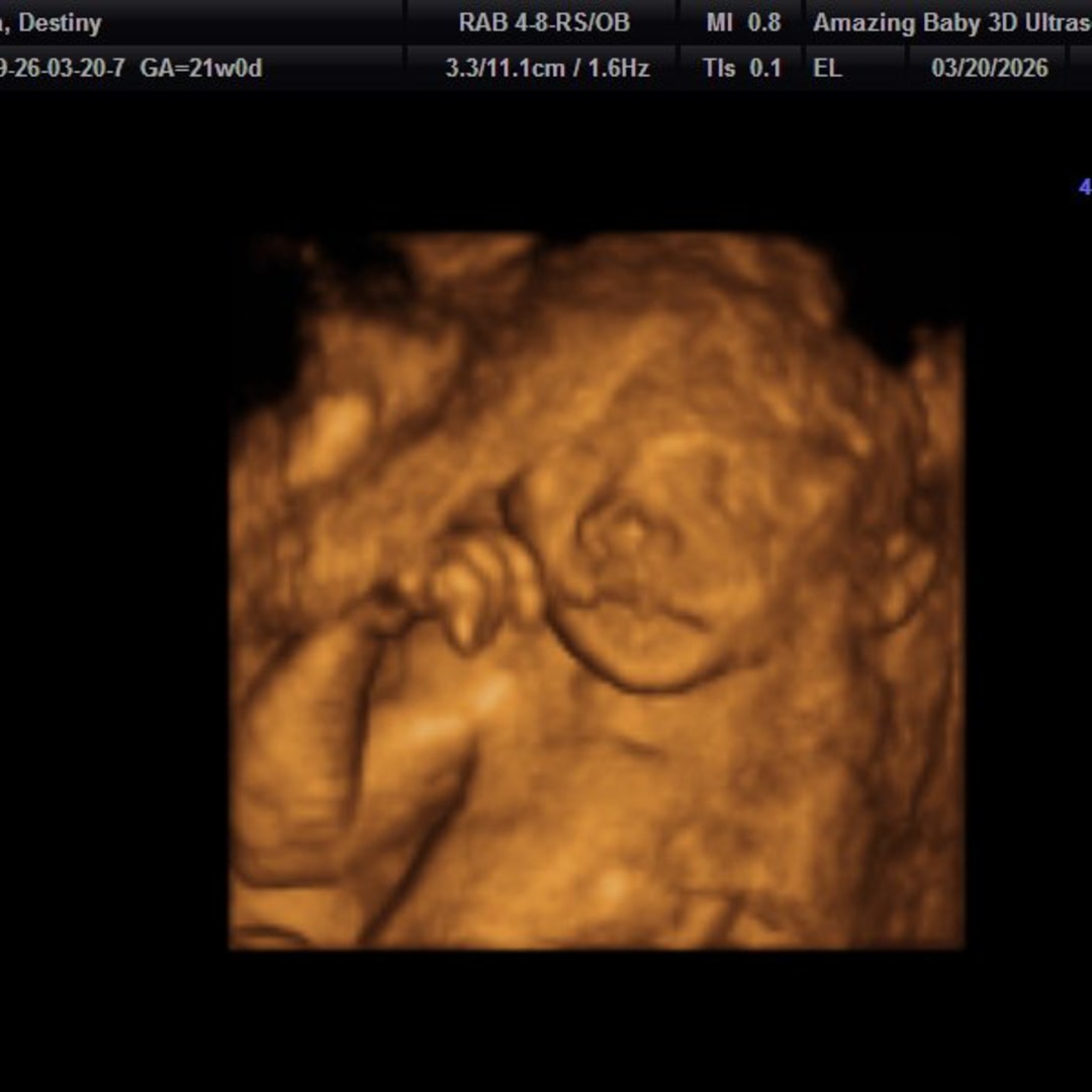 Photo shared by Destiny for their Babylist baby registry.