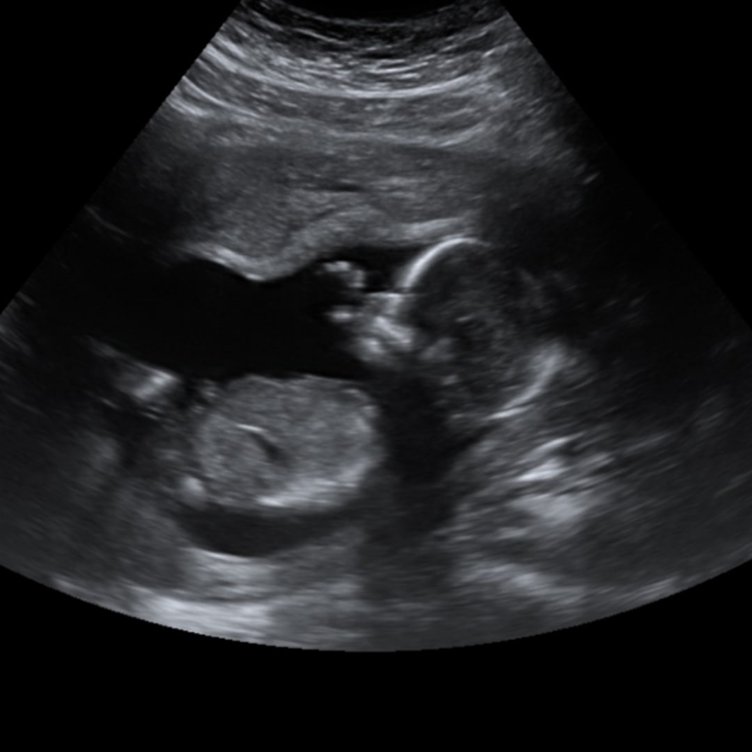 Photo shared by Destiny for their Babylist baby registry.