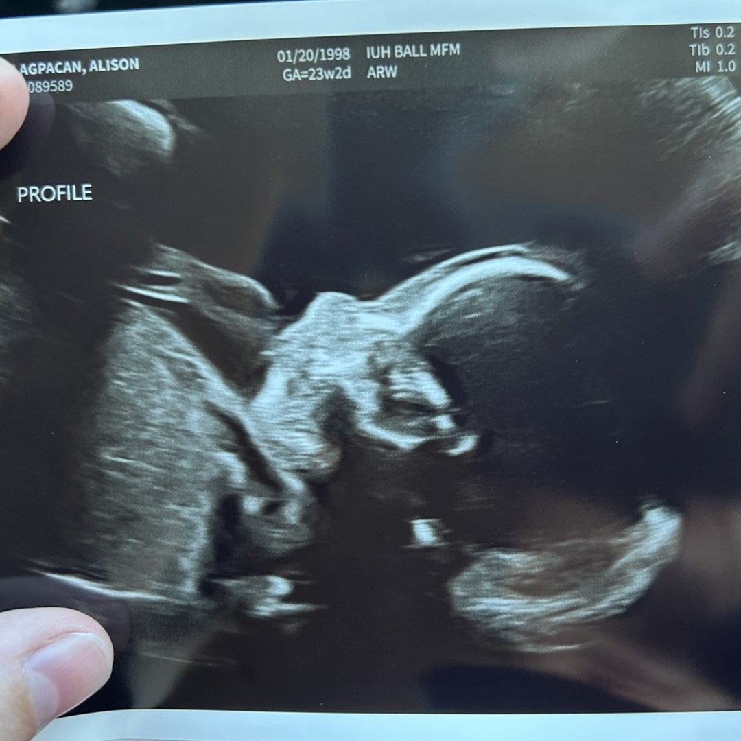 Photo shared by Alison for their Babylist baby registry.