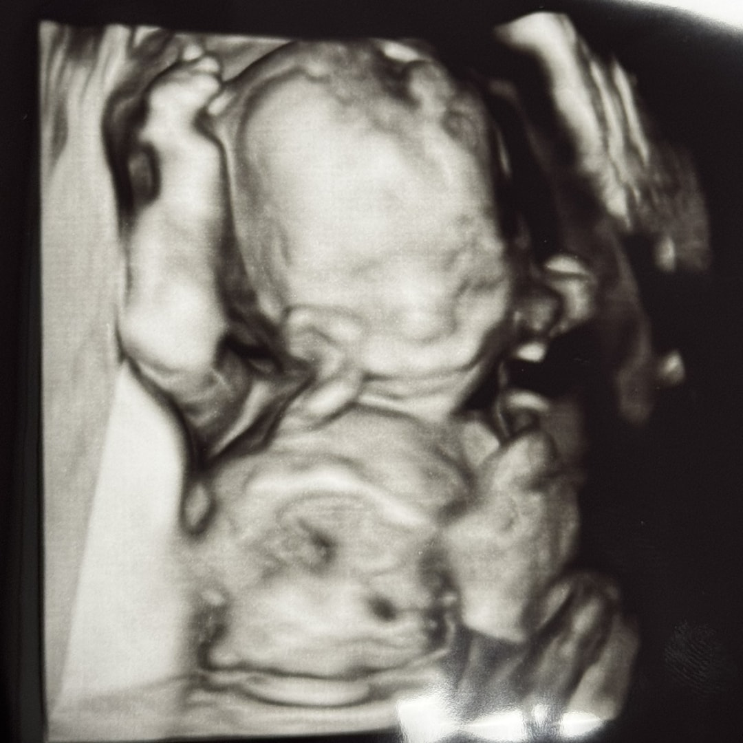 Photo shared by Emma for their Babylist baby registry.
