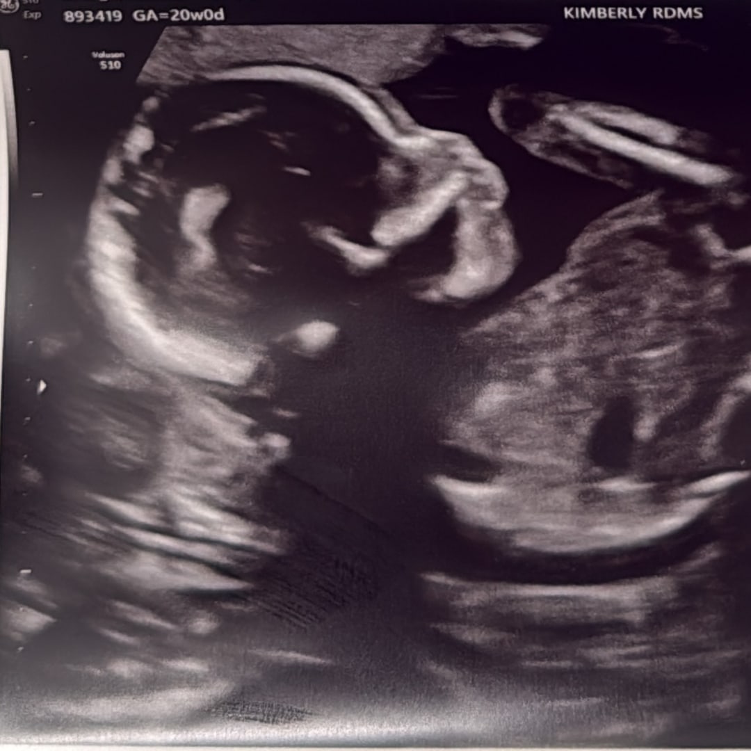 Photo shared by Joanna for their Babylist baby registry.