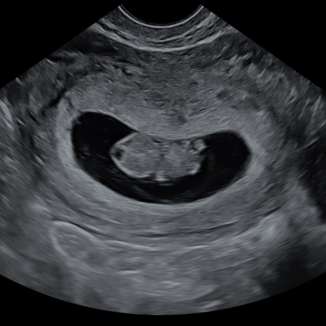 Photo shared by Angela for their Babylist baby registry.