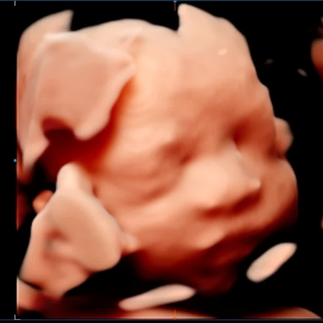 Photo shared by Yossis for their Babylist baby registry.