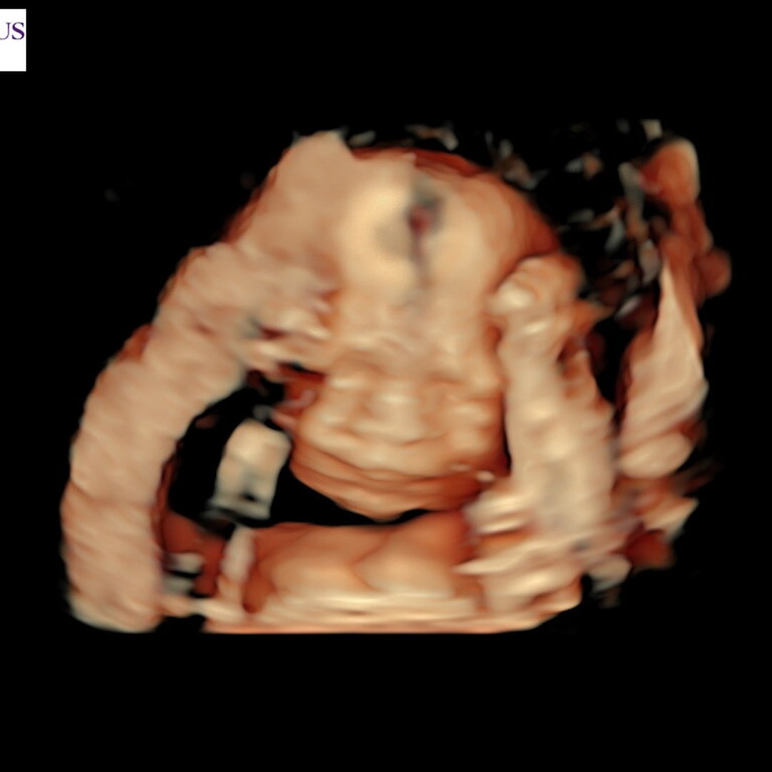 Photo shared by Elizabeth for their Babylist baby registry.