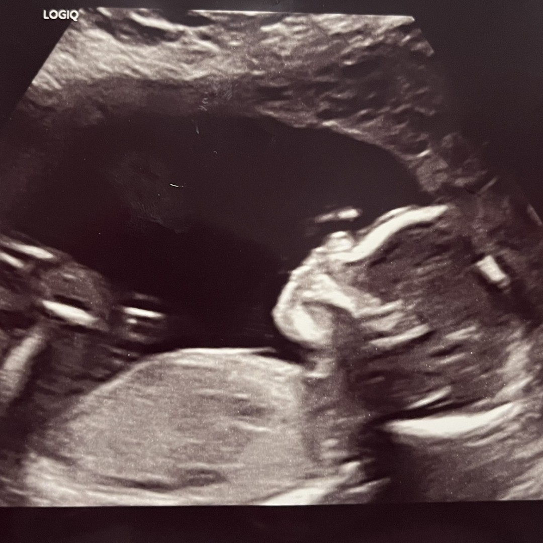Photo shared by Jasmine for their Babylist baby registry.