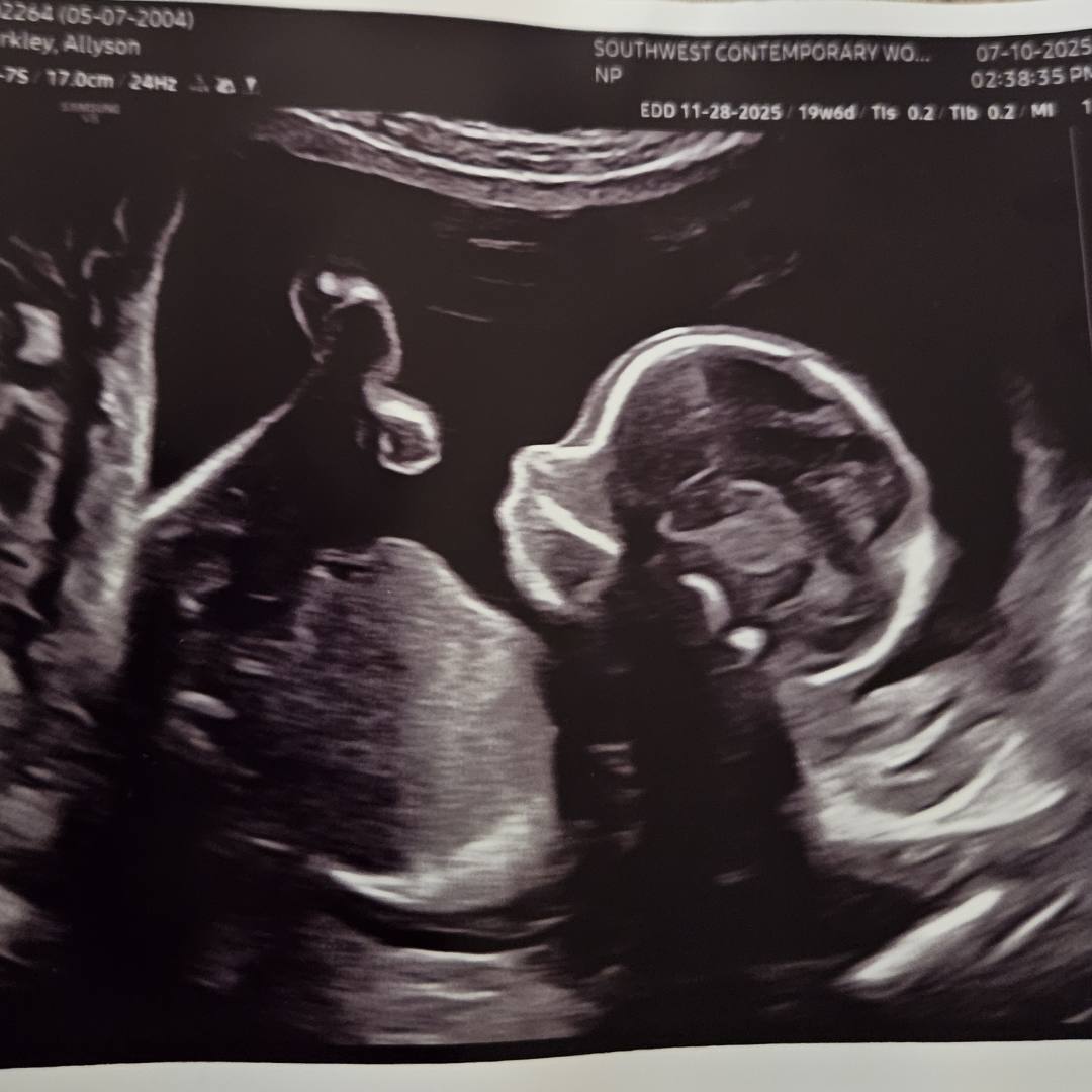 Photo shared by Allyson for their Babylist baby registry.