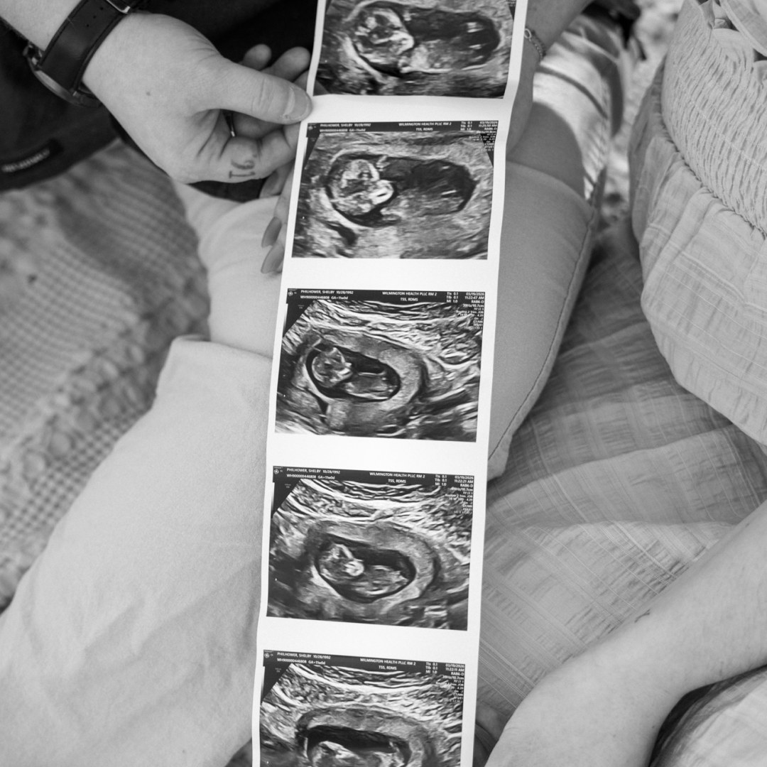 Photo shared by Shelby for their Babylist baby registry.