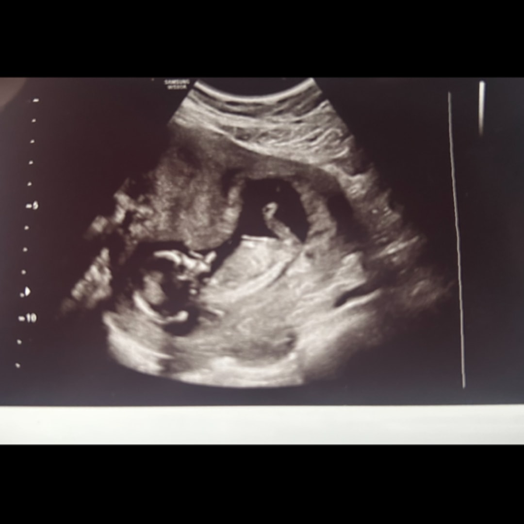 Photo shared by Alexandra for their Babylist baby registry.