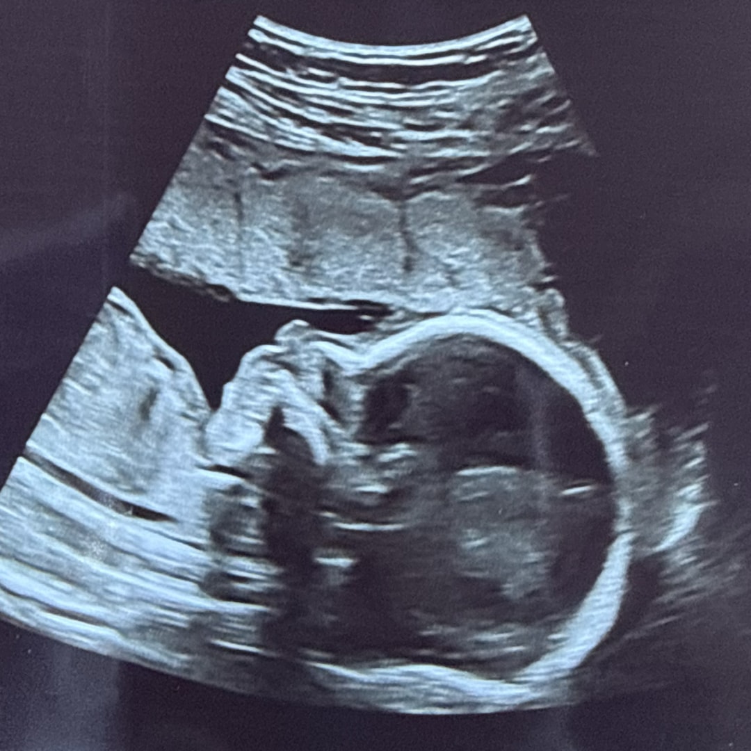 Photo shared by Bianca for their Babylist baby registry.
