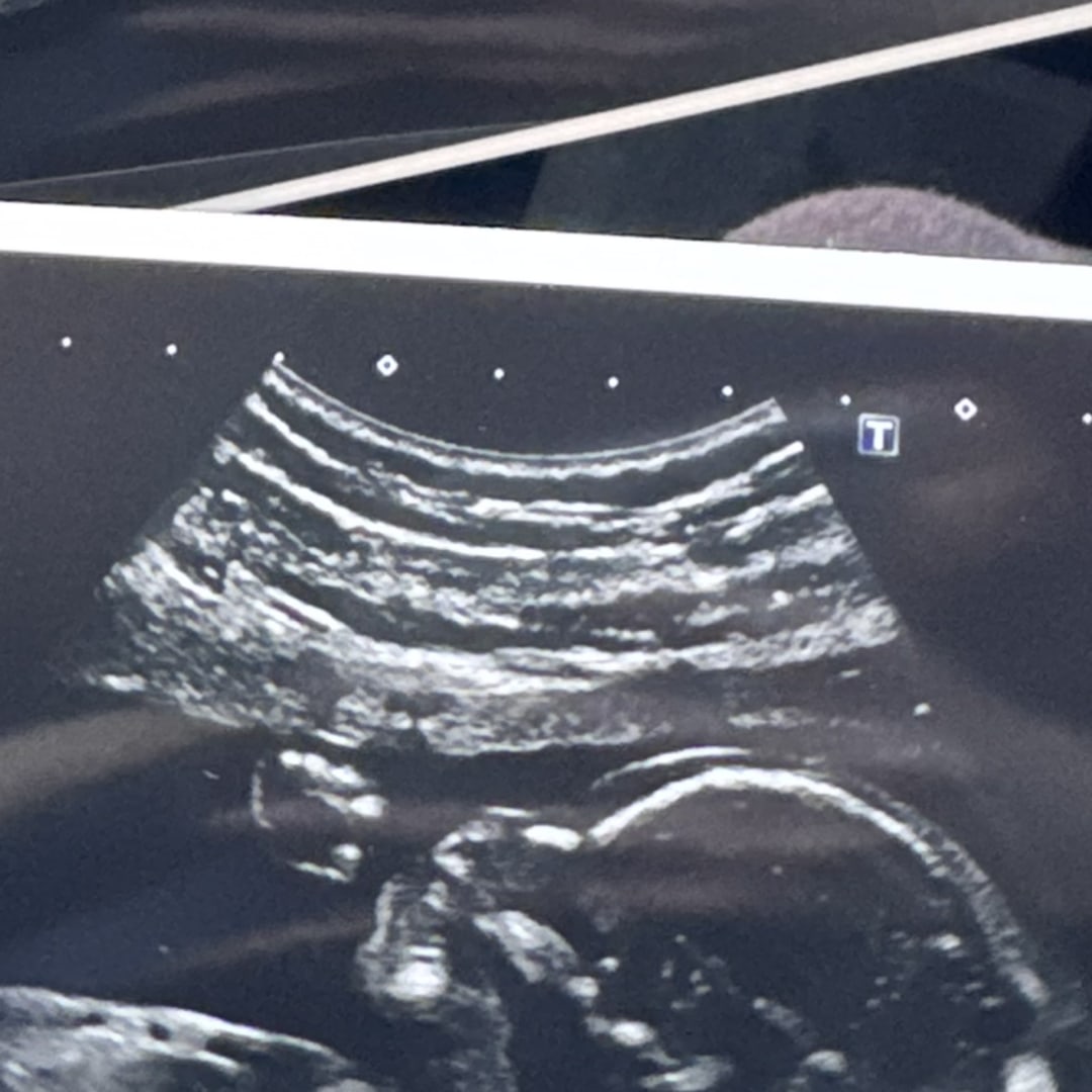 Photo shared by Drew for their Babylist baby registry.