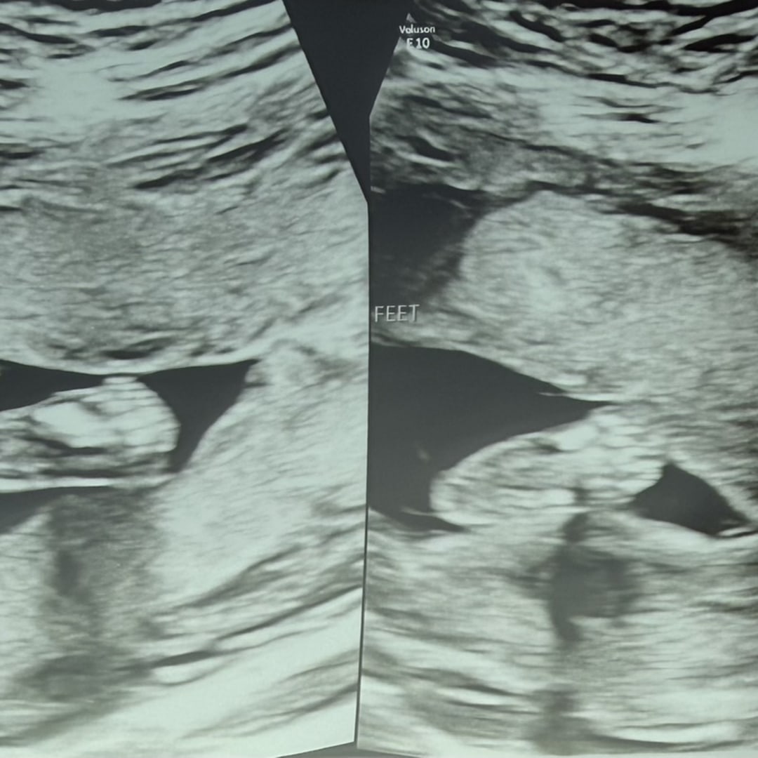 Photo shared by David for their Babylist baby registry.