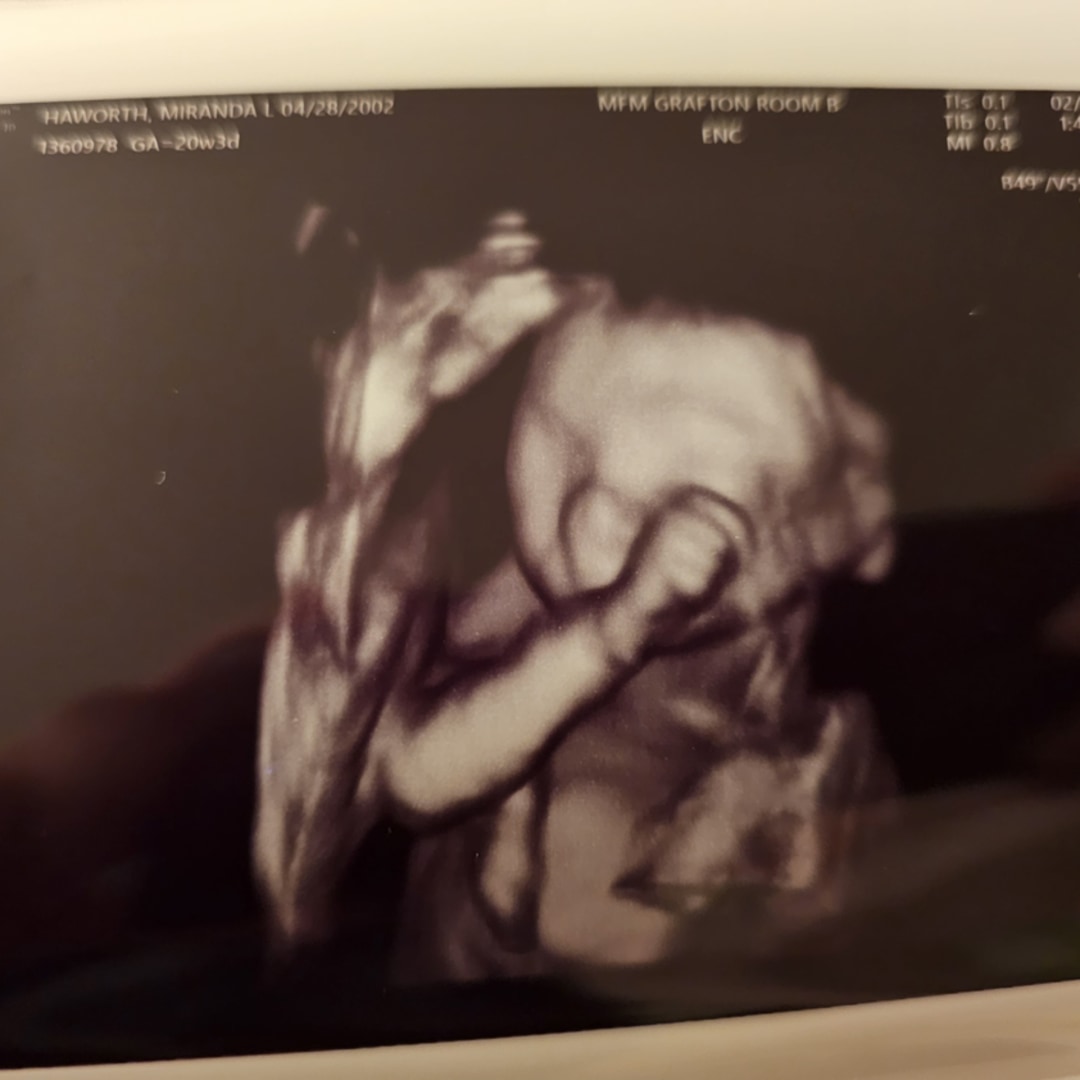 Photo shared by Miranda for their Babylist baby registry.