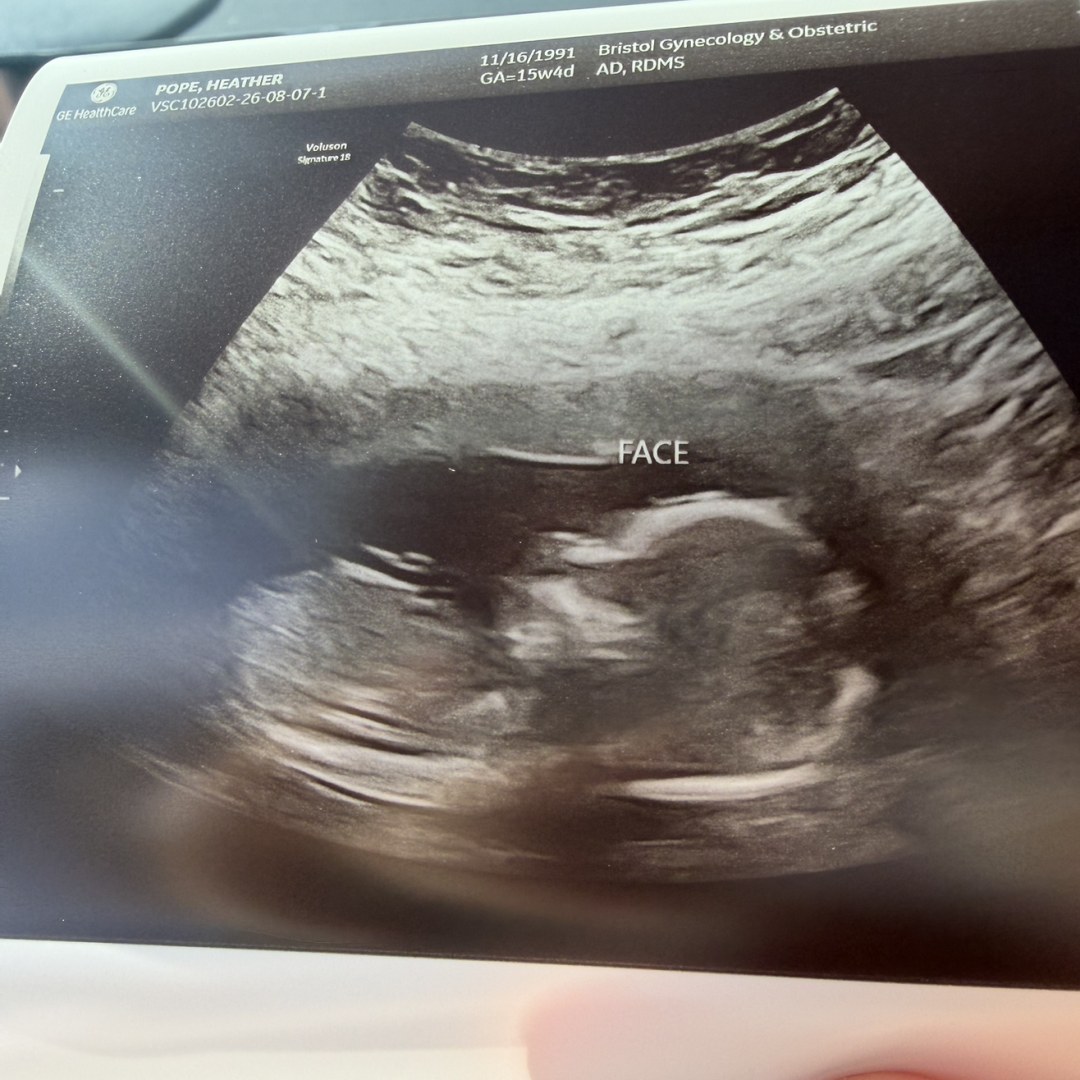 Photo shared by Heather for their Babylist baby registry.