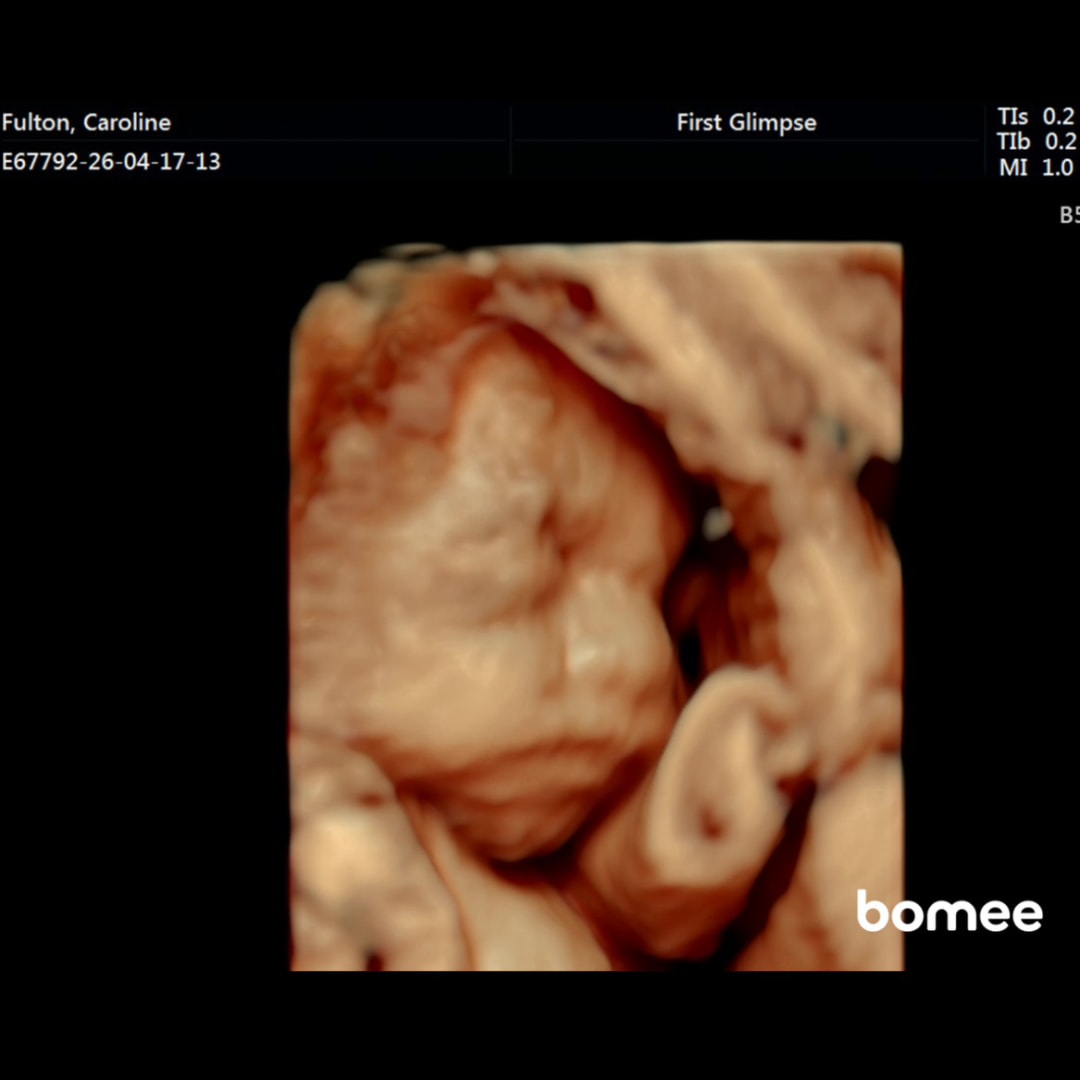 Photo shared by Caroline for their Babylist baby registry.