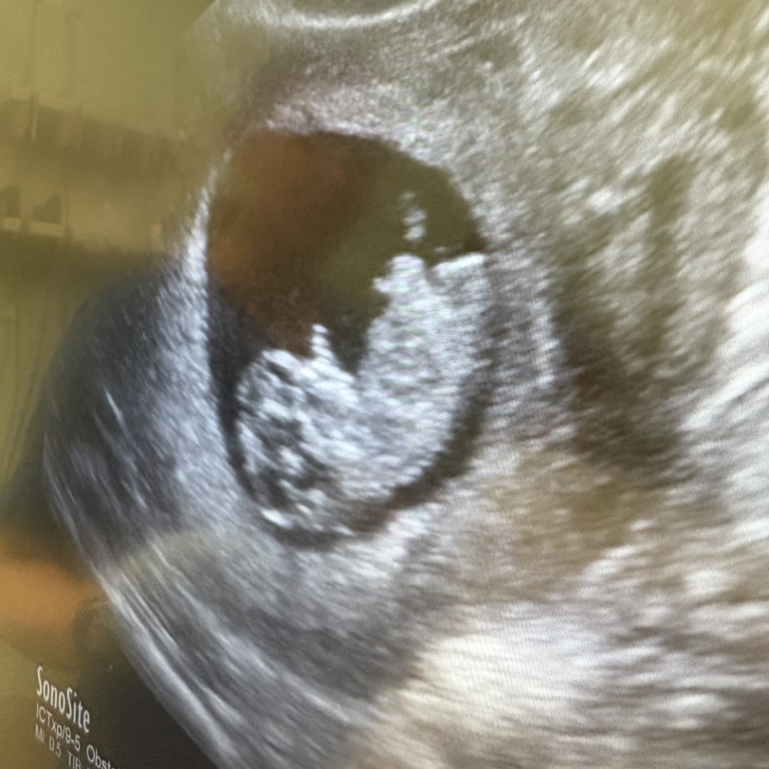 Photo shared by Alexis for their Babylist baby registry.