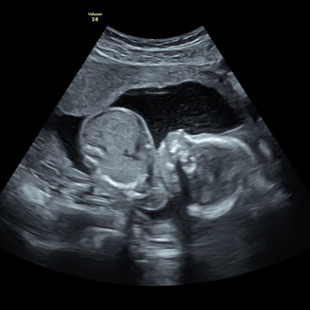 Photo shared by Emily for their Babylist baby registry.