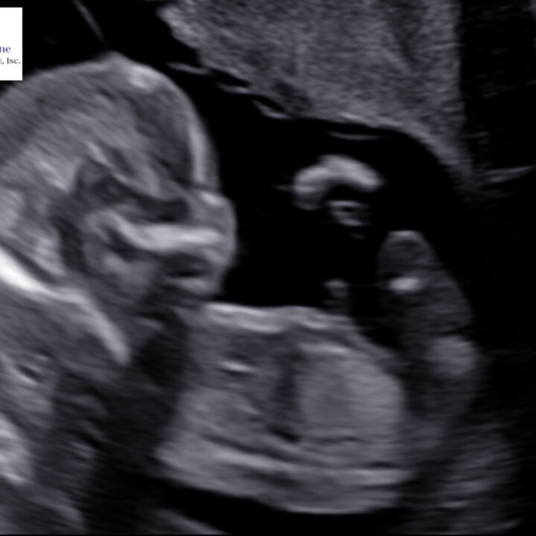 Photo shared by Monica for their Babylist baby registry.