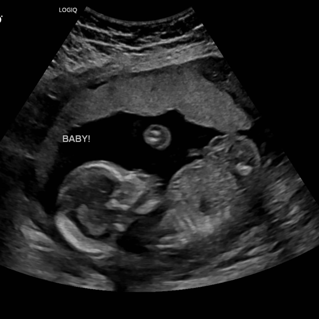 Photo shared by Josie for their Babylist baby registry.