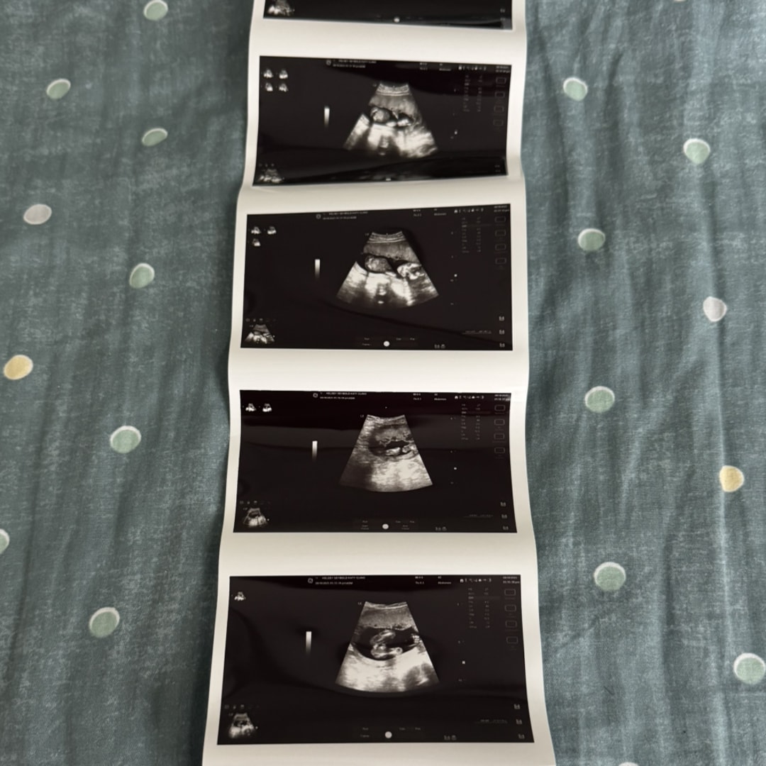 Photo shared by Elizabeth for their Babylist baby registry.