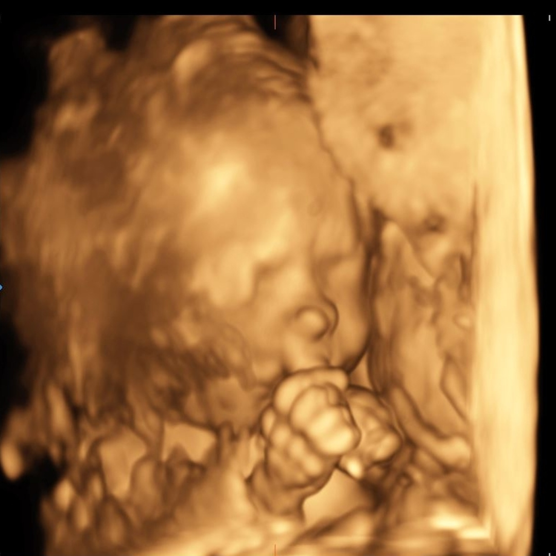 Photo shared by Anissa for their Babylist baby registry.