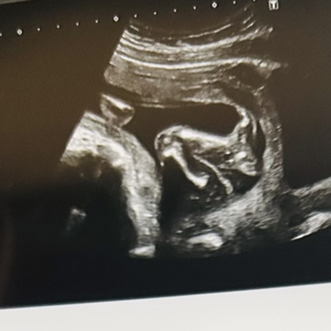 Photo shared by Cheyenne for their Babylist baby registry.