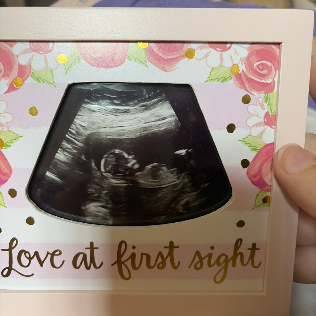 Photo shared by Theresa for their Babylist baby registry.