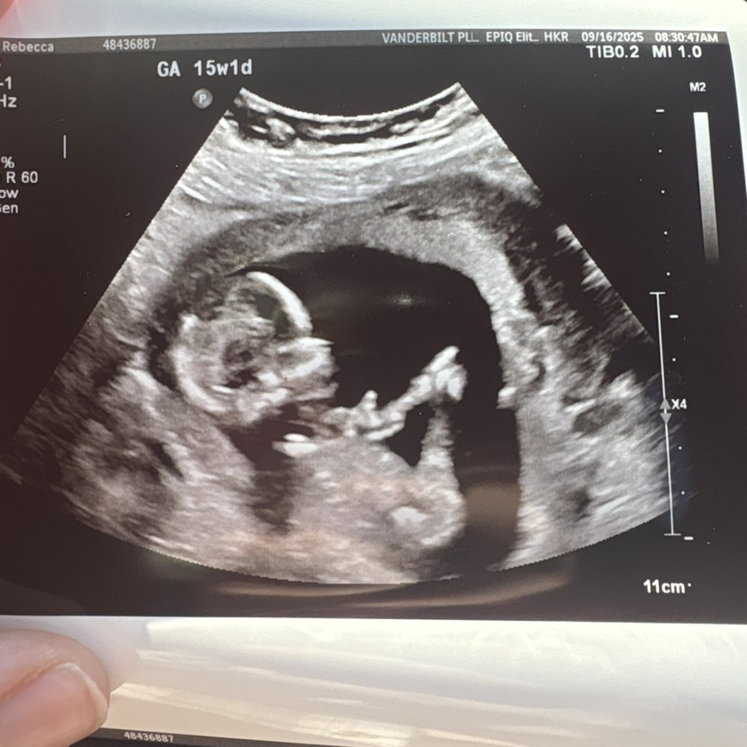 Photo shared by Becca for their Babylist baby registry.