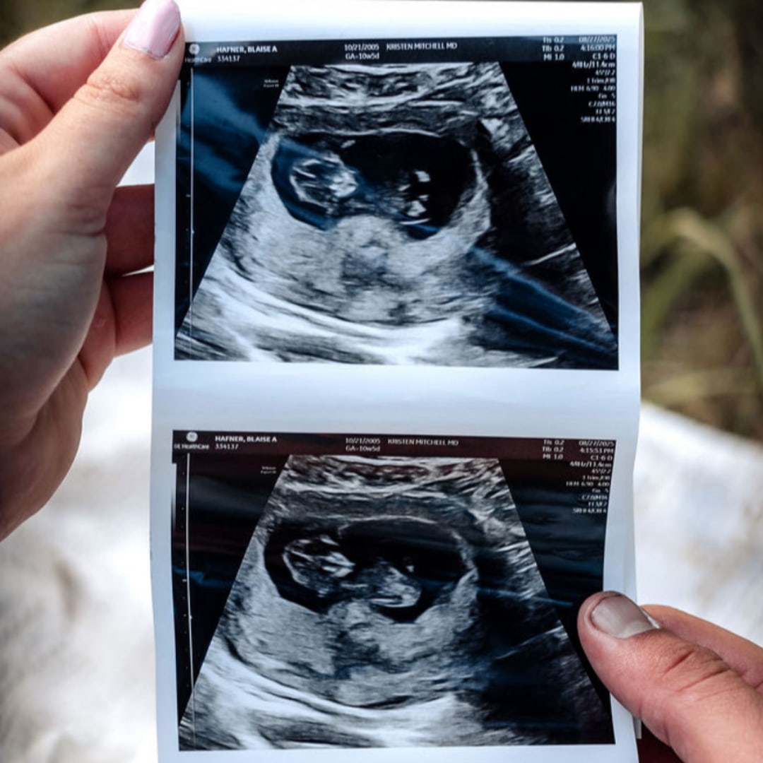 Photo shared by Blaise for their Babylist baby registry.