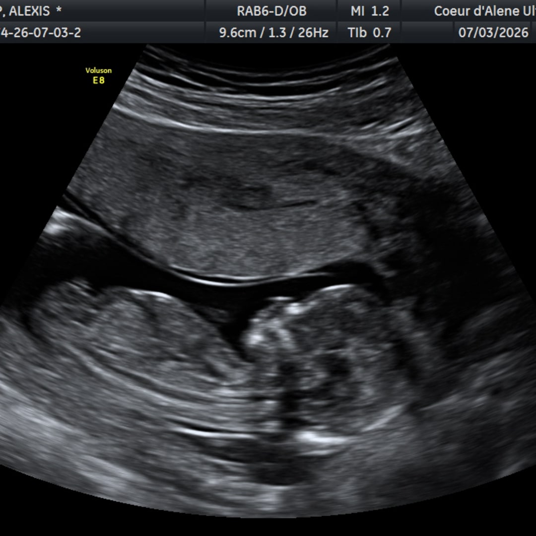Photo shared by Alexis for their Babylist baby registry.