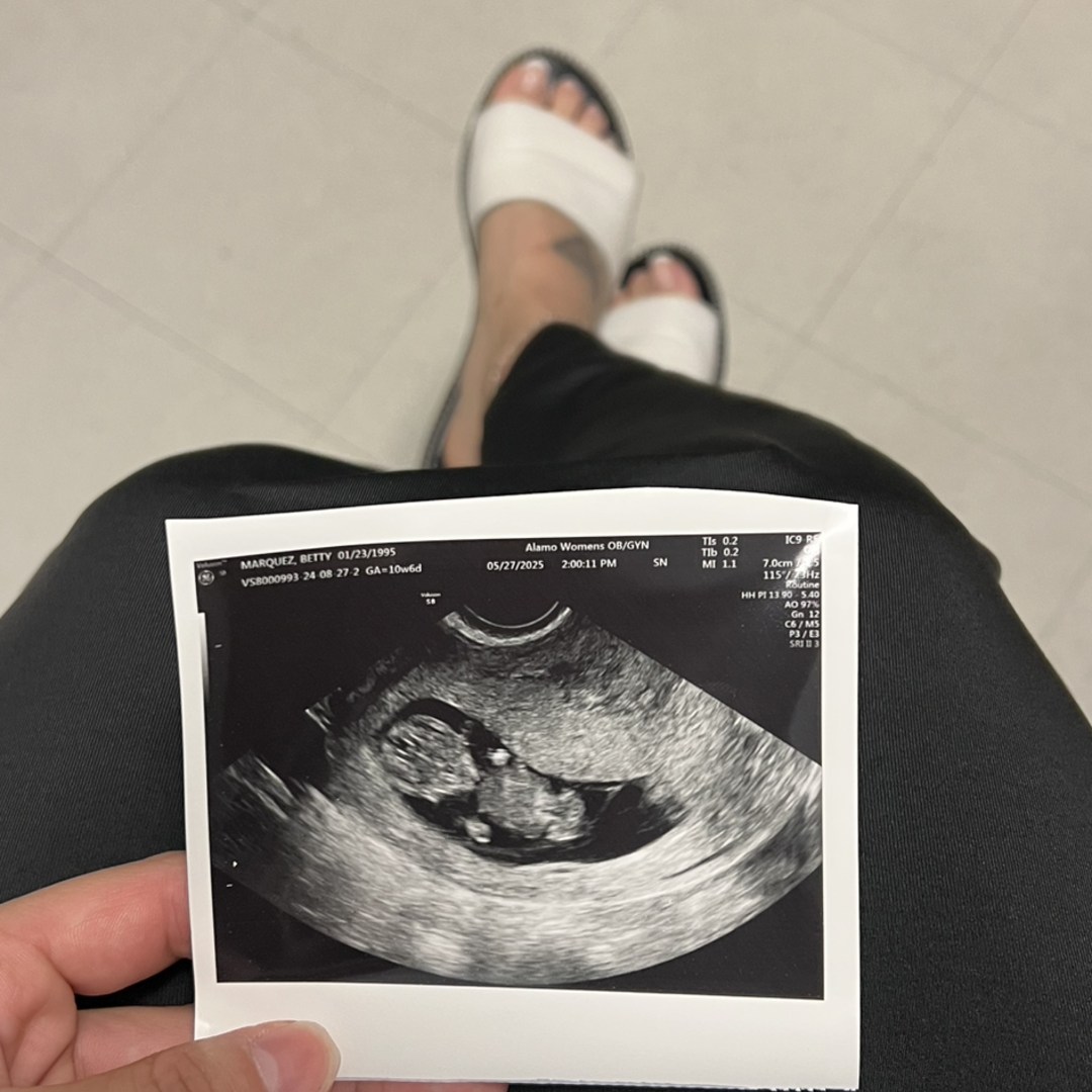 Photo shared by Betty for their Babylist baby registry.