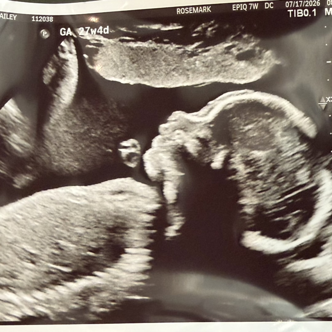 Photo shared by Hailey for their Babylist baby registry.