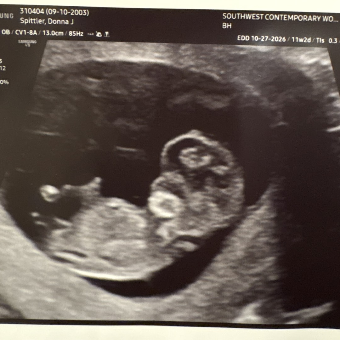 Photo shared by Donna for their Babylist baby registry.