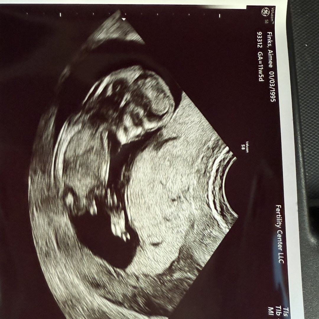 Photo shared by Aimee for their Babylist baby registry.
