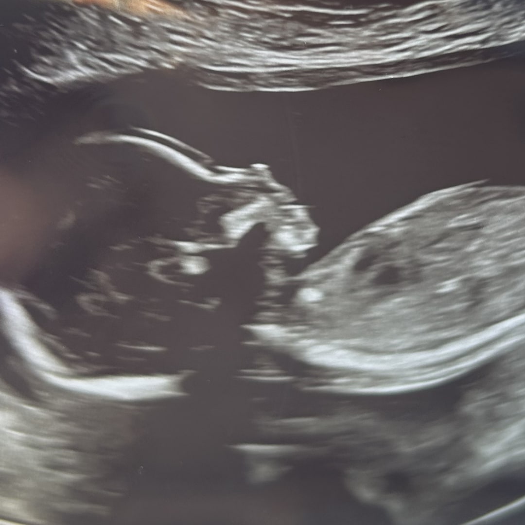 Photo shared by Taylor for their Babylist baby registry.