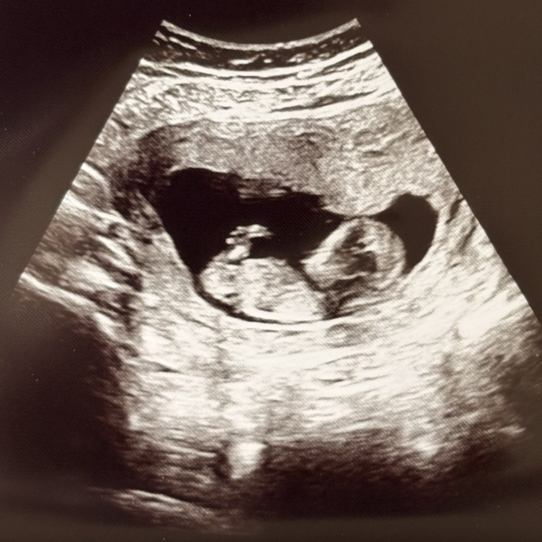 Photo shared by Christina for their Babylist baby registry.