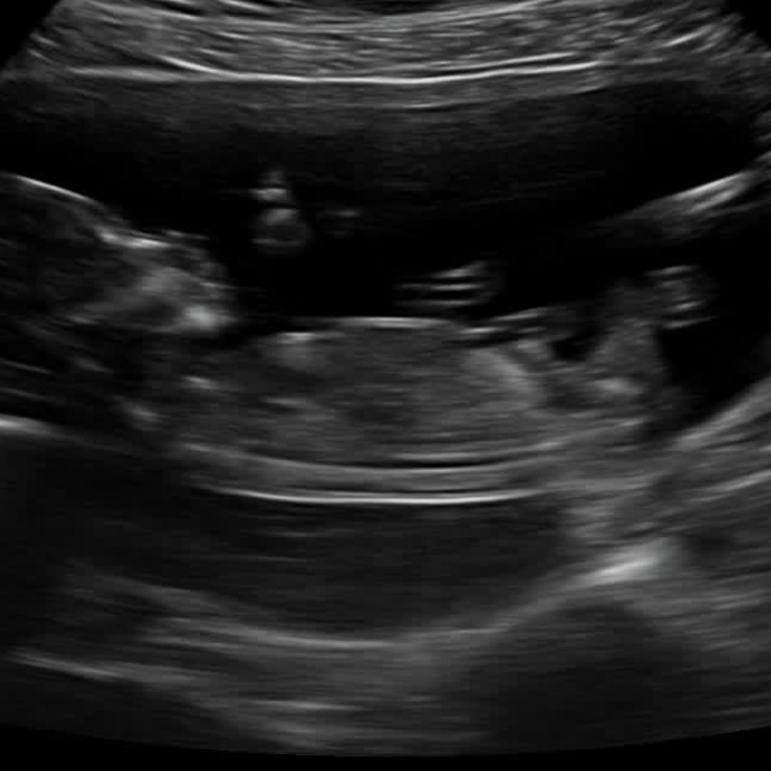 Photo shared by Norah for their Babylist baby registry.
