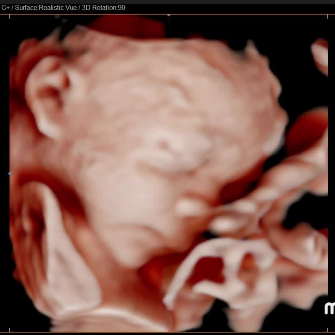 Photo shared by Charmaine Faye for their Babylist baby registry.