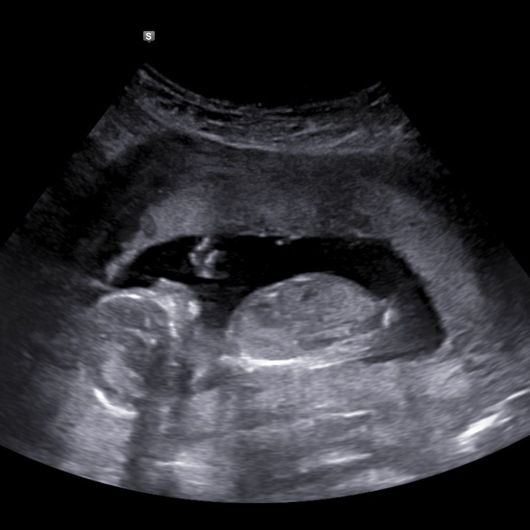 Photo shared by Ashley for their Babylist baby registry.