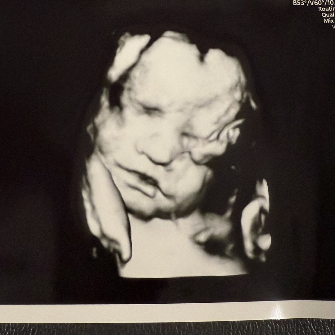 Photo shared by Megan for their Babylist baby registry.