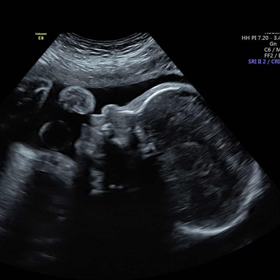 Photo shared by Selena for their Babylist baby registry.