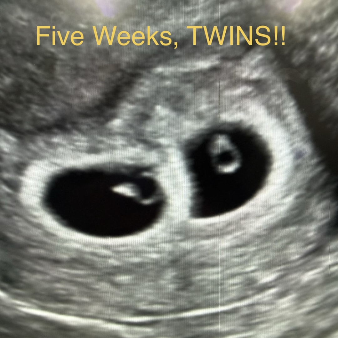 Photo shared by Christyn for their Babylist baby registry.