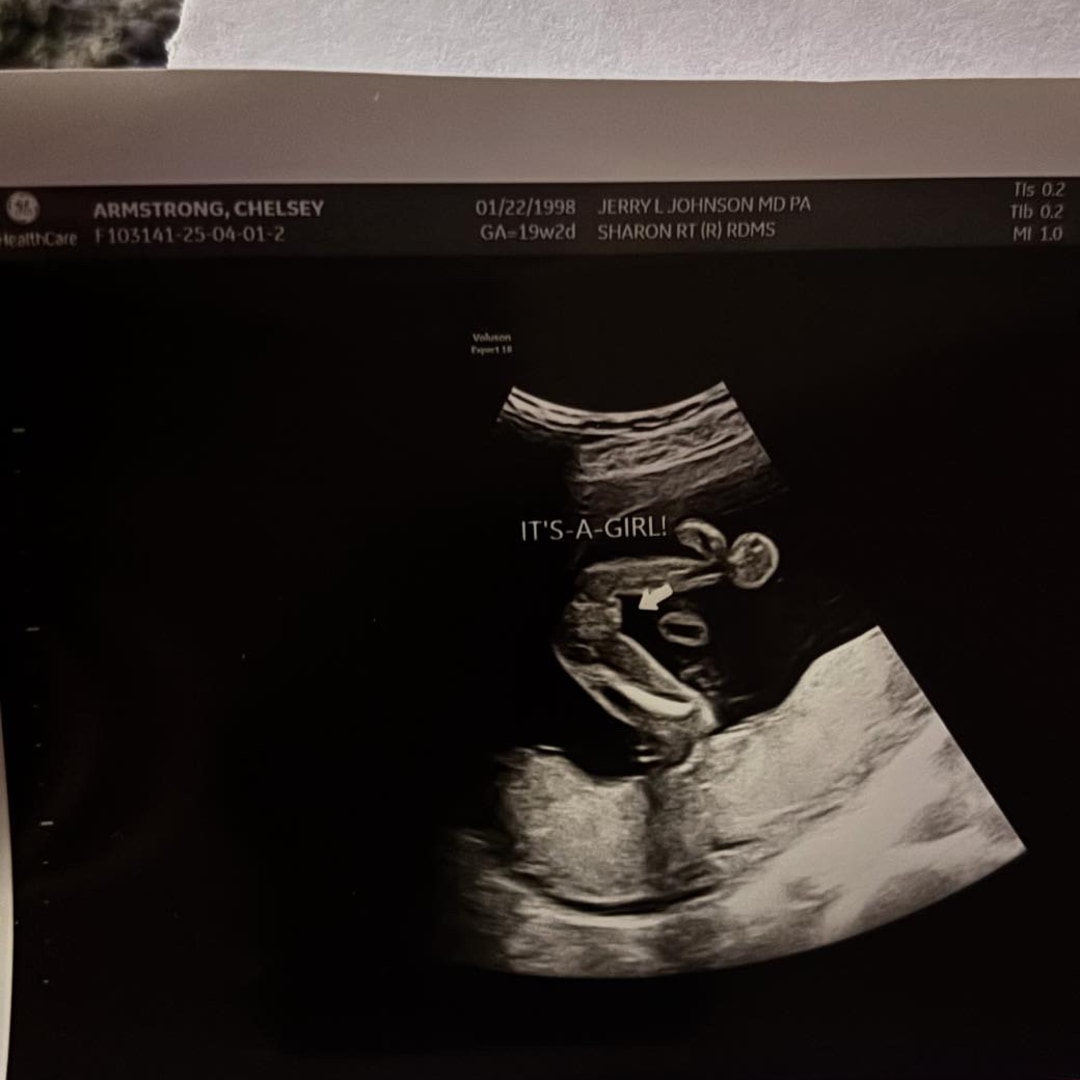 Photo shared by Chelsey for their Babylist baby registry.